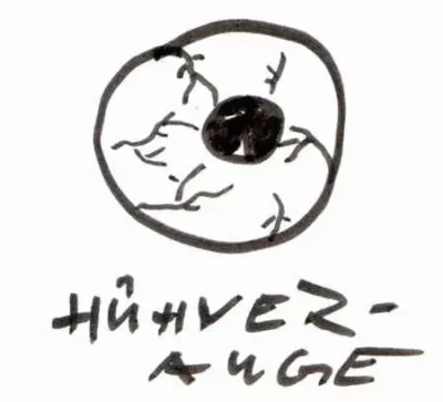 Huehnerauge_raag